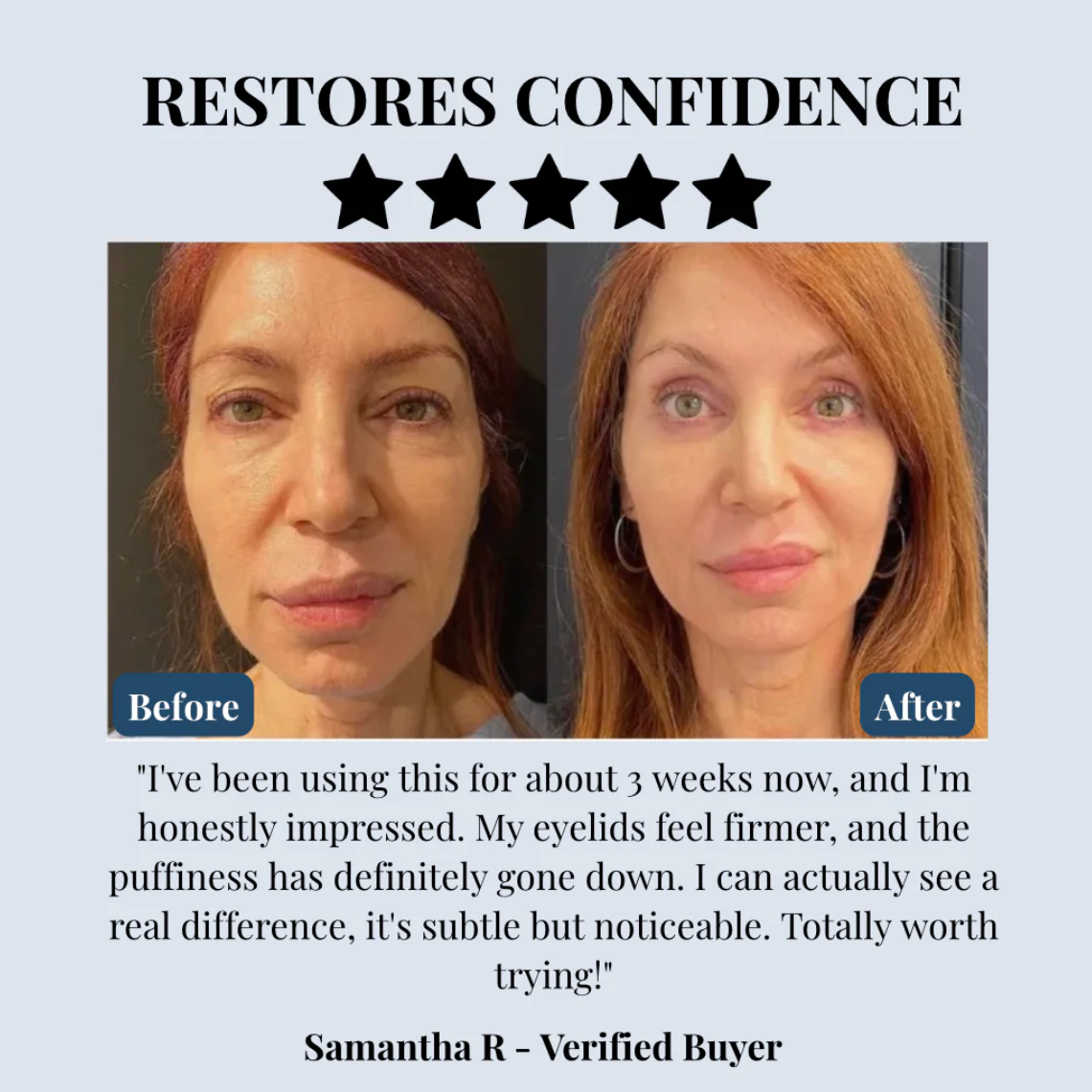 Maison Belle Lid Lifting Treatment